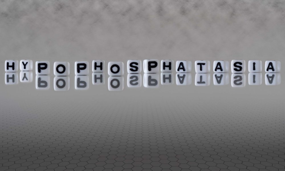 hypophosphatasia word or concept represented by black and white letter cubes on a grey horizon background stretching to infinity